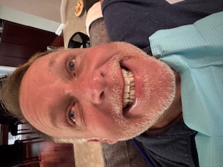 Before whitening 1